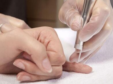 Провеждане на лазерна терапия